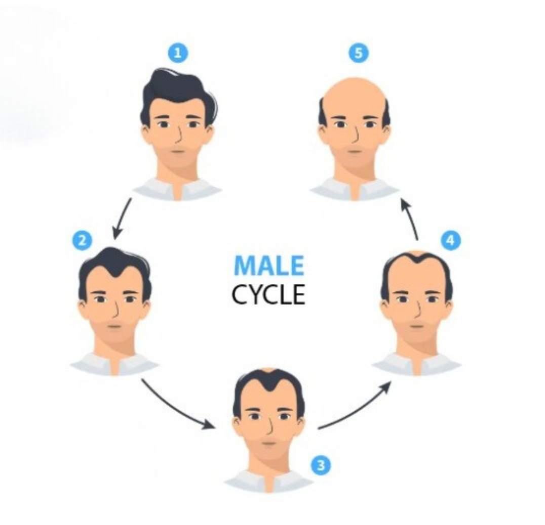 Male Hair Problems