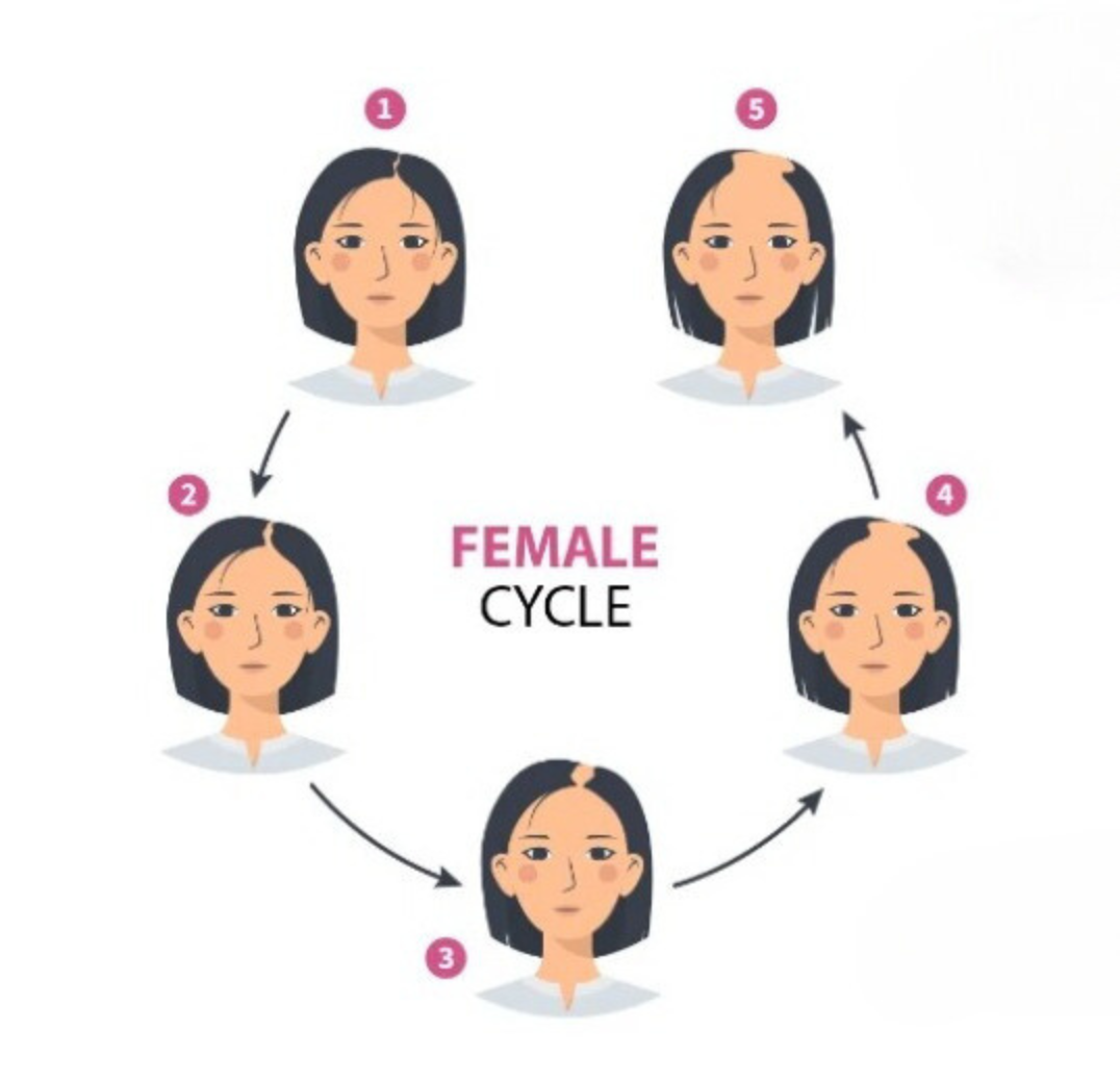 Female Hair Problems